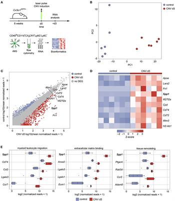 Secreted Phosphoprotein 1 Expression in Retinal Mononuclear Phagocytes Links Murine to Human Choroidal Neovascularization